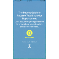 Reverse Total Shoulder Replacement - Patient Guide